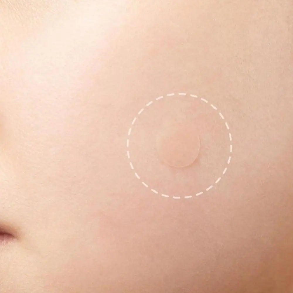 Patchs Hydrocolloïdes Stop-Boutons